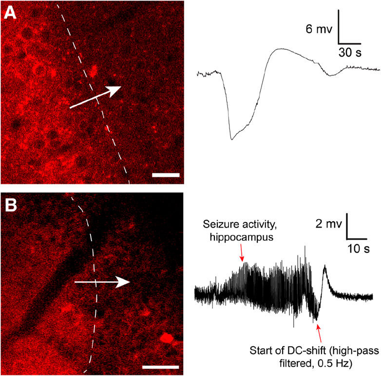 Astrocytes as critical players of the fine balance between inhibition and excitation in the brain: spreading depolarization as a mechanism to curb epileptic activity